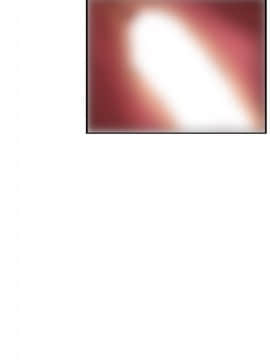 Super Dick_ 024 100